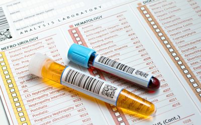83 – Functional Lab Tests for ADHD with Dana Kay